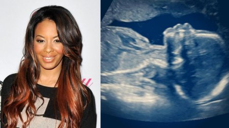 Vanessa Simmons Pregnant With First Child